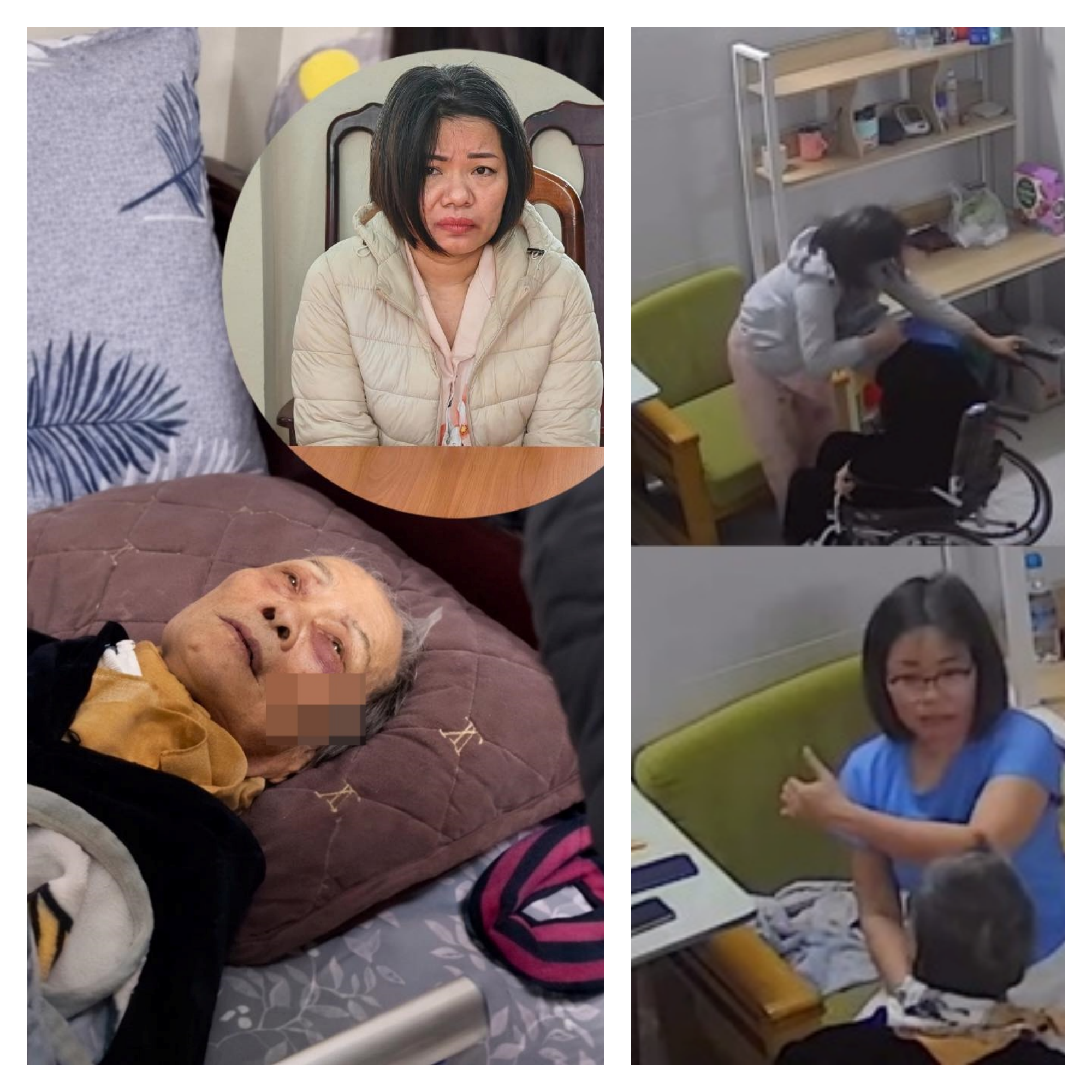 Tình trạng sức khoẻ cụ bà 82t bị người giúp việc b.a.oha.n.h suốt thời gian dài